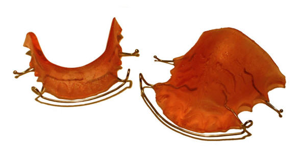 Retainers,Graz,Stabilisierung,Wachstum,Schienen,Weiterbildung,Geräte,Zahnspange,Erwachsene, Zahnärztin,Kieferorthopädie,medizinisch,Kieferorthopäde Graz,Kieferorthopäden