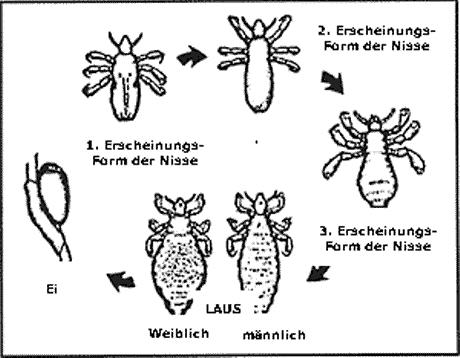 flöhe läuse,hausmittel gegen läuse,läuse haare,läuse kindergarten,läuse vorbeugung,kopfläuse vorbeugen, läuse behandlung,läuse bekämpfung,läuse kinder,läuse vorbeugen,hausmittel gegen kopfläuse, läuse und nissen,kopflaus info,kopfläuse bekämpfung