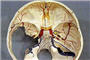 Neurochirurgie