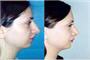 Plastische Chirurgie