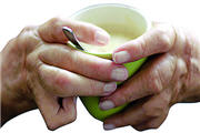 Rheumatologie