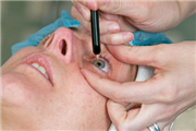 Laseroperation,Laseroperation Augen,Laseroperationen,lasik Augenoperation,lasik op,lasik Operation,leben ohne Brille