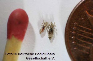 läuse,laus,ausgewachsene männliche und weibliche Kopflaus,kinder,hunde,katzen,after,festhalten,gelaehmt,insektizide,filzläuse 