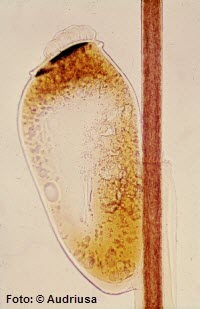 Kopflaus,Eier,kopfläuse,speichel,parasiten,läuse,laus,rüssel,kommunen,larve,nass,nisse,keine anzeichen,kopflaus,bakterien im darm,festhalten,gelähmt,insektizide