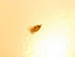 Kopflaus,Pediculus humanus capitis,läuse,laus,untersuchung,diagnose,kiefer,migration,vitamine,haarfarbe,kinderarzt,kontrolle,nass,nisse,permanent