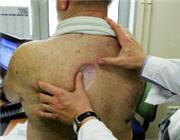 Arthritis Therapie, Arthrose, Arthrose Behandlung, Arthritis, Arthritis Arthrose, Arthritis Behandlung, Arthritis bei, Arthritis Diagnose