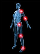 Gelenkschmerzen, Ernährung bei Rheuma, Fibromyalgie, gegen Rheuma, Gelenk, Gelenkbeschwerden, Gelenkentzündung, Gelenkschmerz
