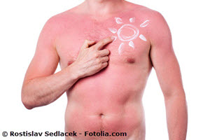 Unbeschwerte Freude an der Sonne - Hautkrebs-Erkrankungen steigen !