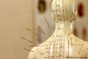 Akupunktur und Varianten in der Schmerztherapie